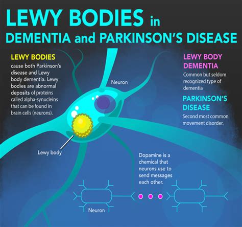 lewy body dementia and parkinson's symptoms